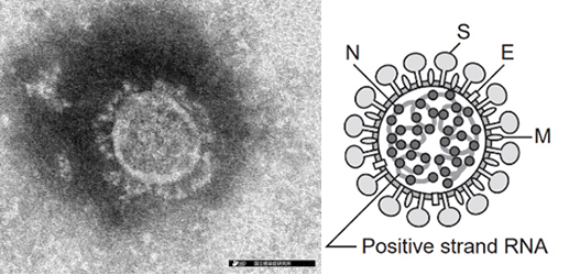 新型コロナウイルスの電子顕微鏡写真（左）とその模式図（右）